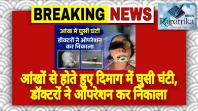 राजपत्रिका : आंखों से होते हुए दिमाग में घुसी घंटी, डॉक्टरों ने ऑपरेशन कर निकाला KSHITITECH